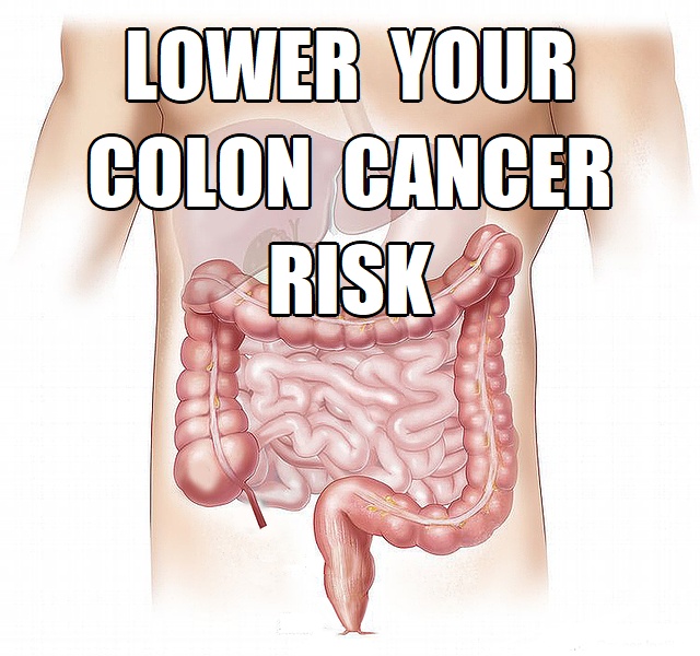 prevent colon cancer