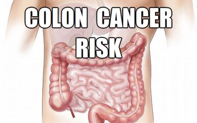 7 Steps To Lower Colon Cancer Risk